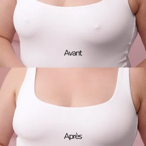 Coussinettes adhésives invisibles - Image 8