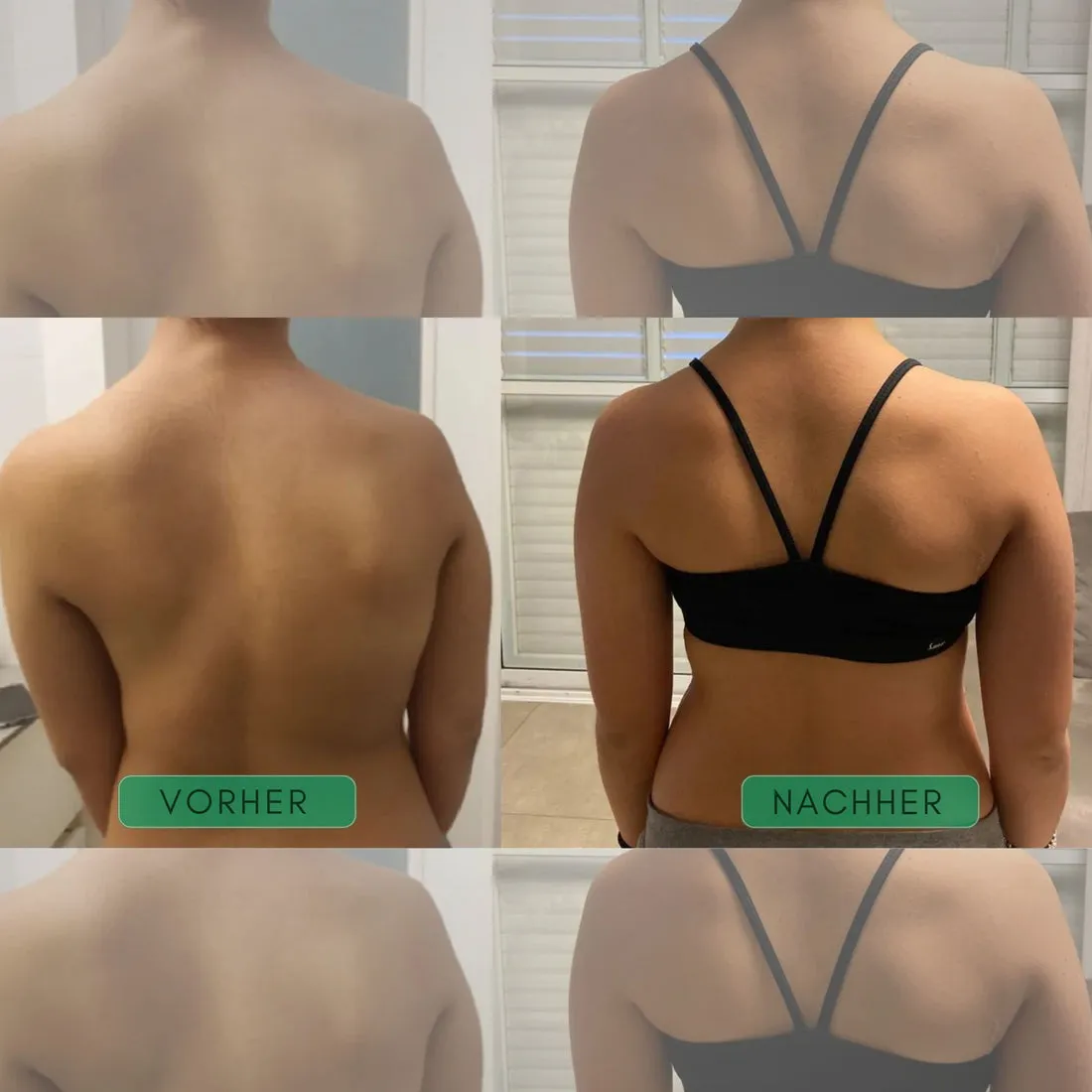 AlignFlex™ Correcteur de posture - Image 2