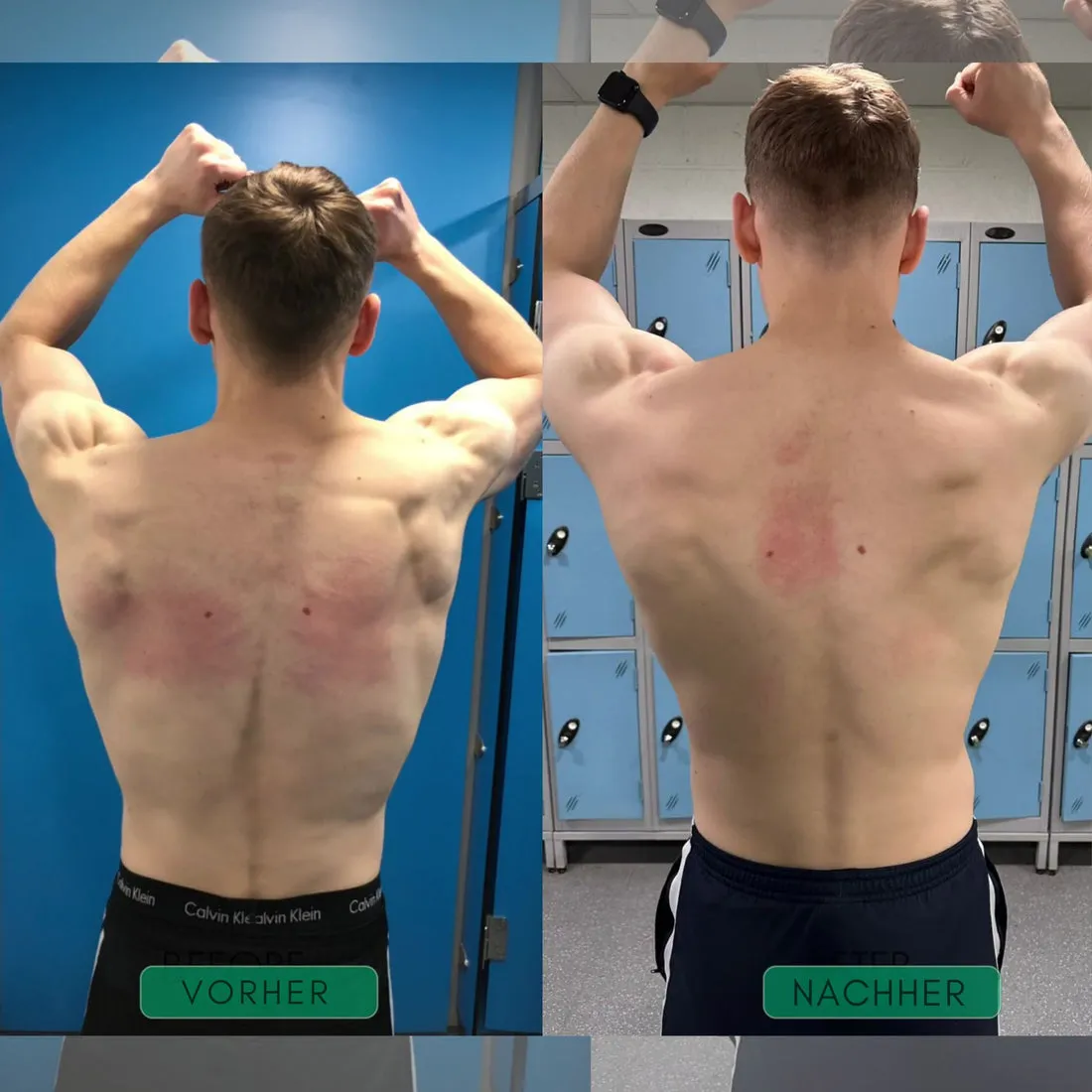 AlignFlex™ Correcteur de posture - Image 3