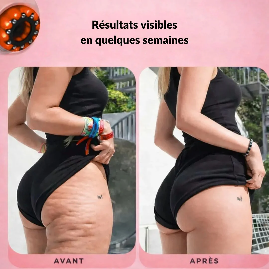 Appareil Anti-Cellulite Chauffant - Image 3