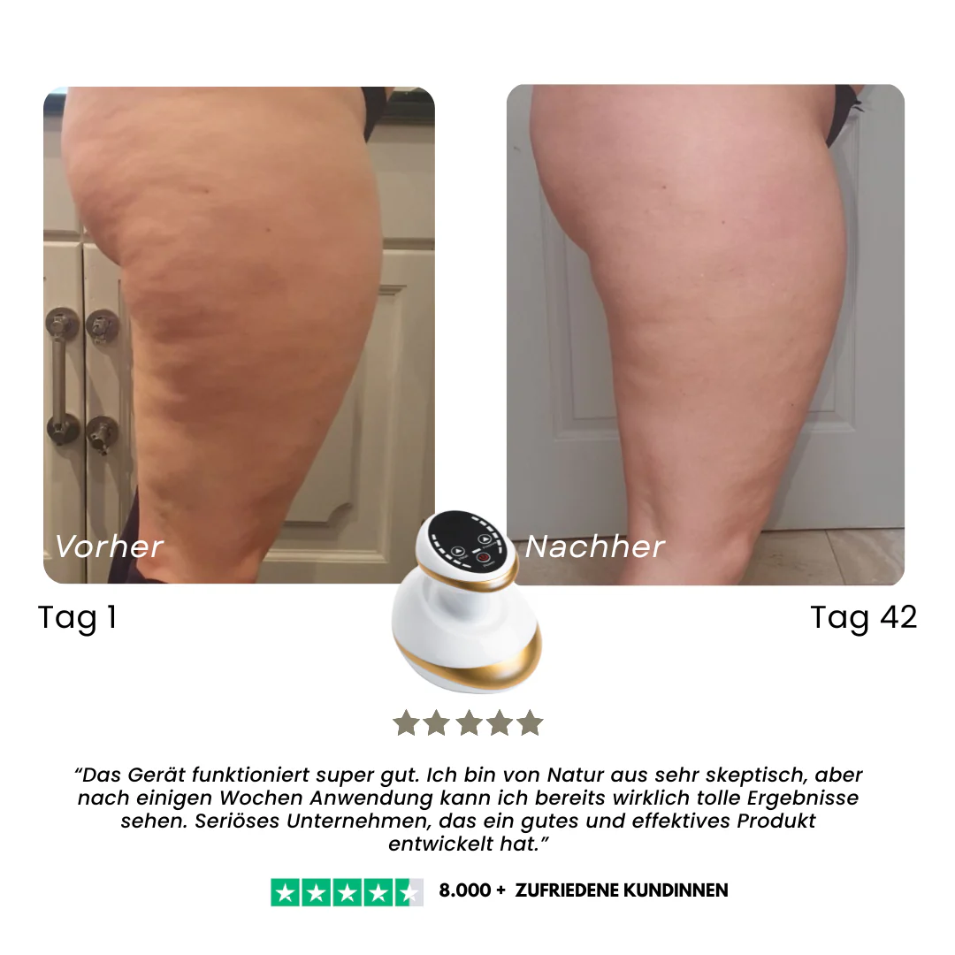 Appareil de massage anti-cellulite chauffant - Image 2