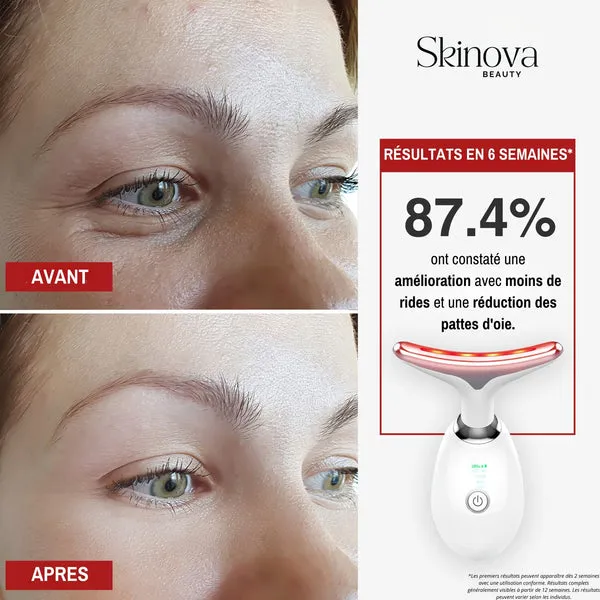 Appareil - Anti-âge - Image 6