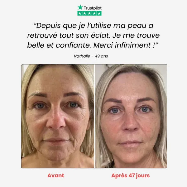 Appareil - Anti-âge - Image 8