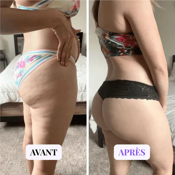 Appareil de massage minceur anti-cellulite - Image 2