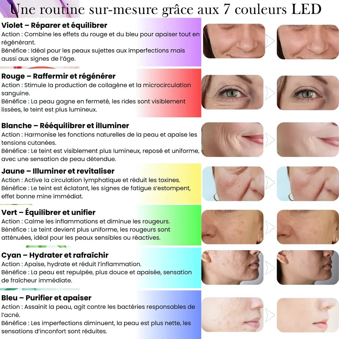Appareil Multi-Soins Visage 7 en 1 - Image 5