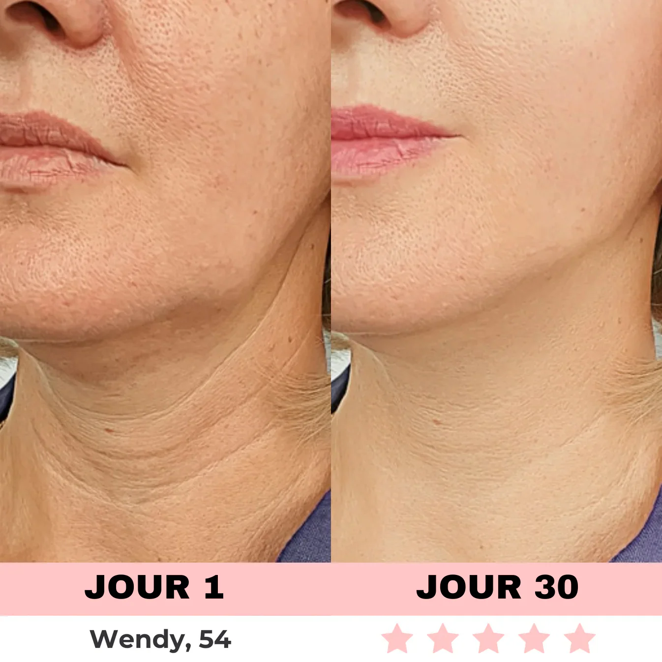 Appareil de Soins de la Peau à Lumière LED - Image 3
