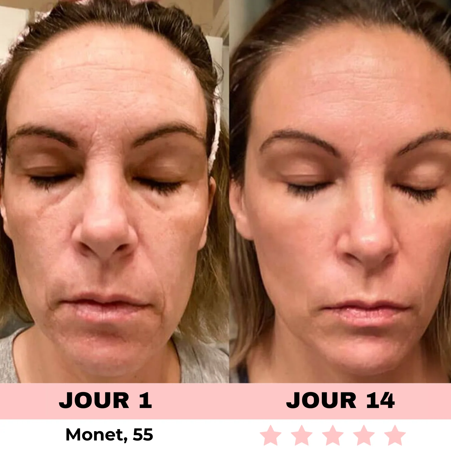 Appareil de Soins de la Peau à Lumière LED - Image 5