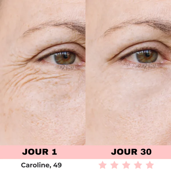 Appareil de Soins de la Peau à Lumière LED - Image 7