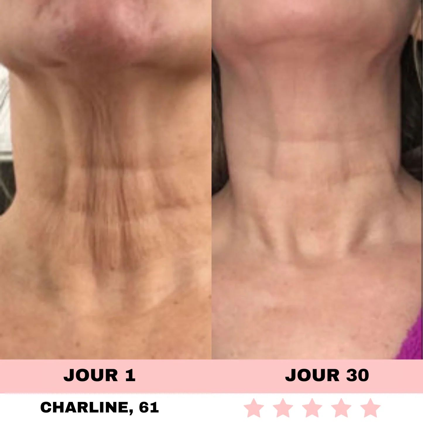 Appareil de Soins de la Peau à Lumière LED - Image 8