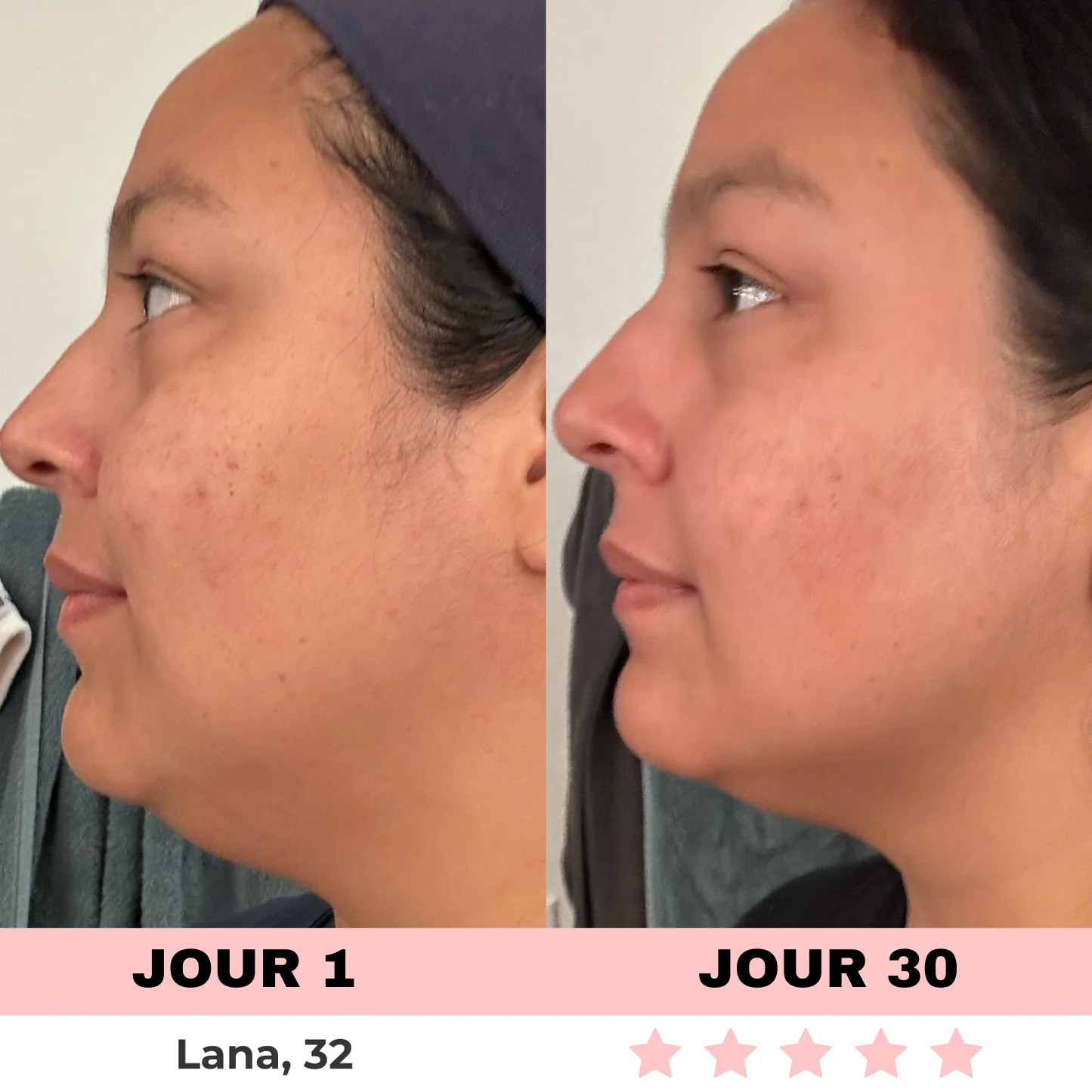 Appareil de Soins de la Peau à Lumière LED - Image 9