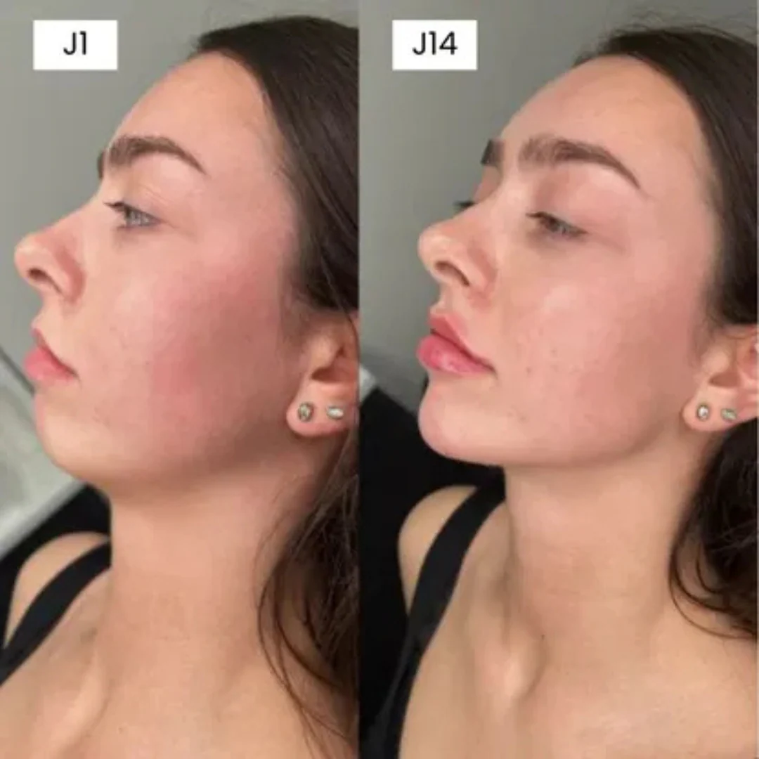 Bande de maintien visage - Image 2