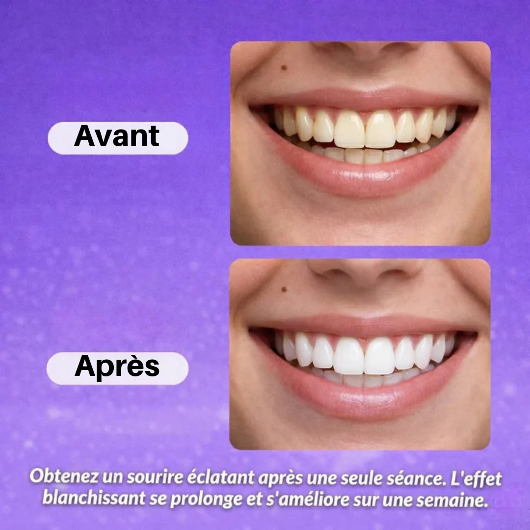 Bandes blanchissantes dentaires - Image 3