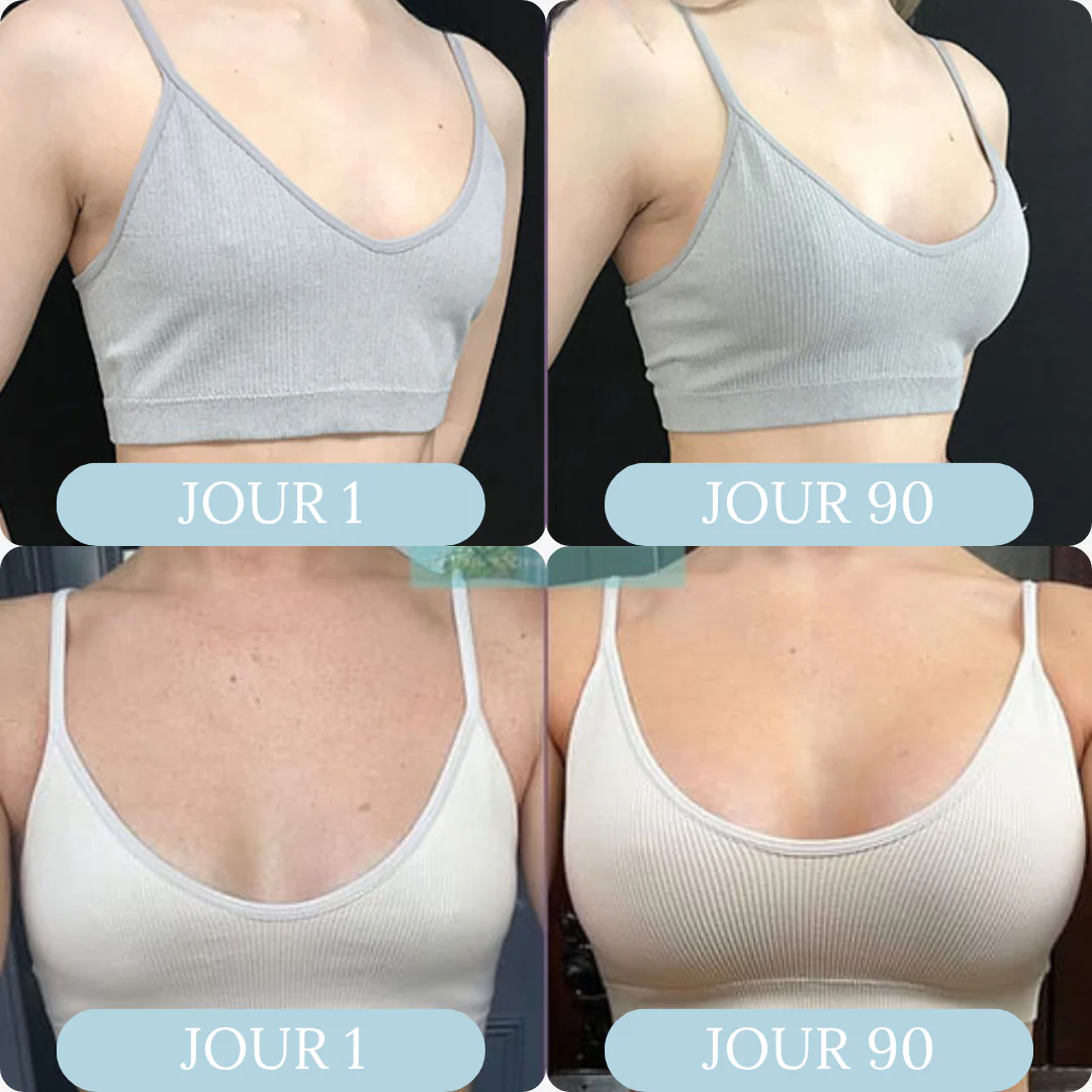 BUST'UP - Patch mammaire - Image 3