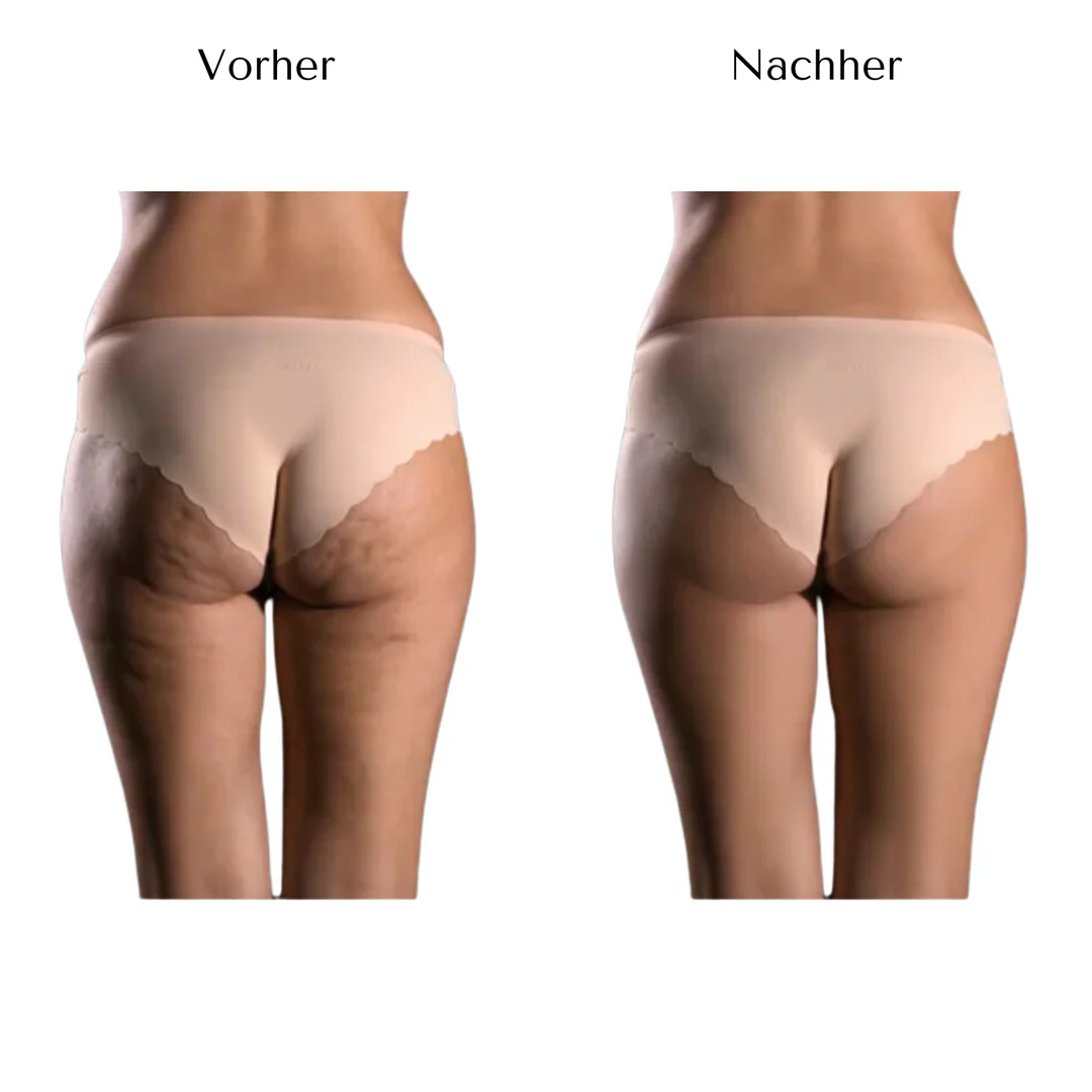 CelluCare - Image 6