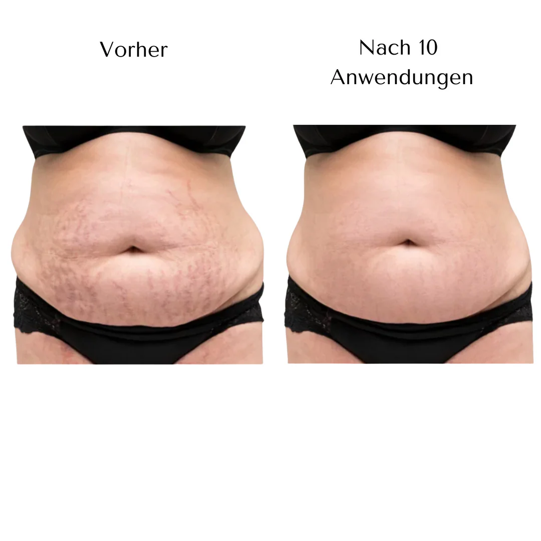 CelluCare - Image 8