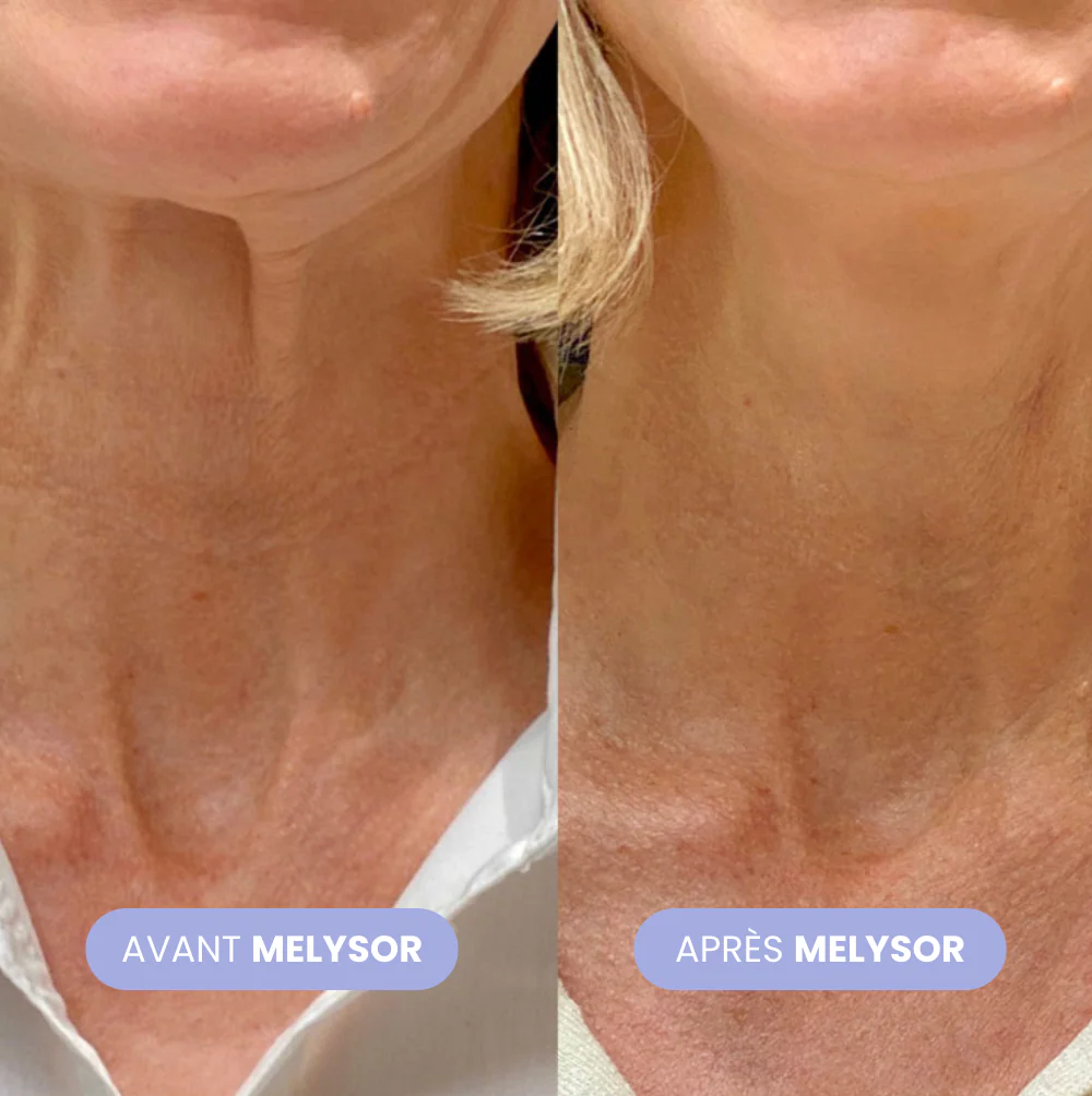 Crème Lifting Cou - Image 3