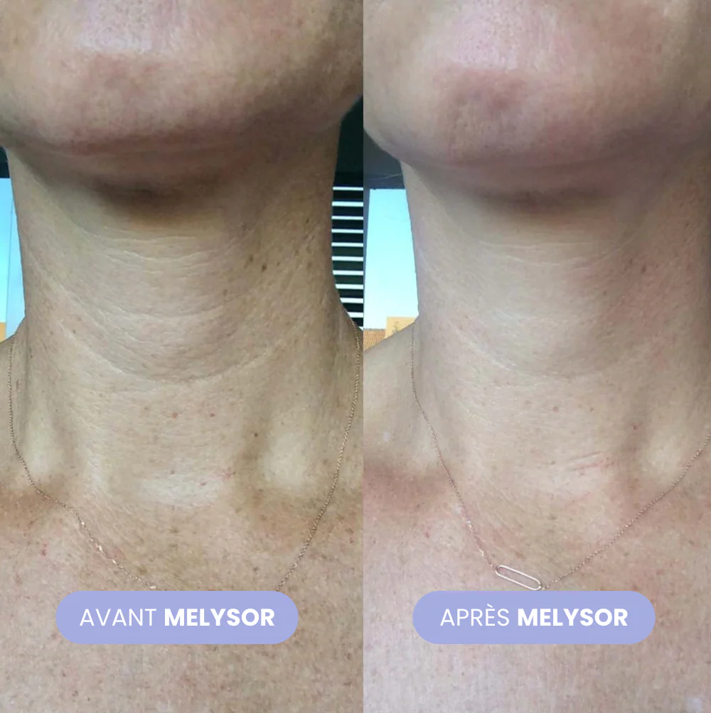Crème Lifting Cou - Image 4