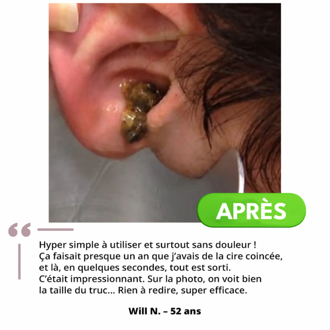 Nettoyeur auriculaire doux et efficace - Image 7