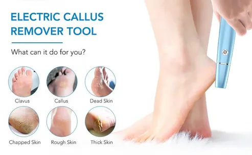 Éliminateur de callosités électrique pour les pieds - Image 9