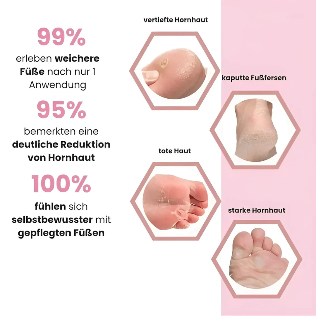 Éliminateur de callosités électrique pour un soin doux des pieds - Image 5