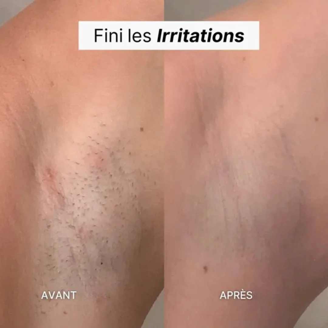 Épilateur exfoliant doux - Image 10