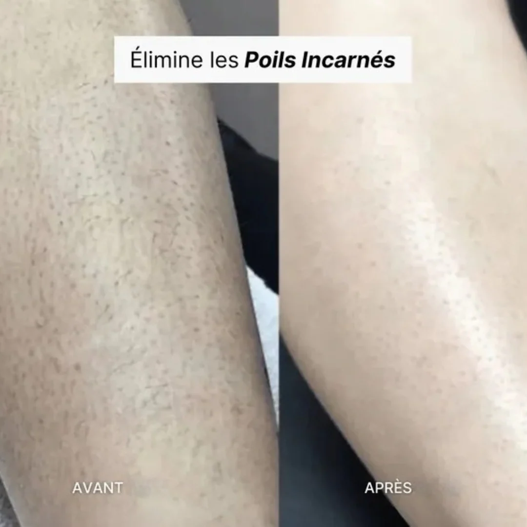 Épilateur exfoliant doux - Image 11
