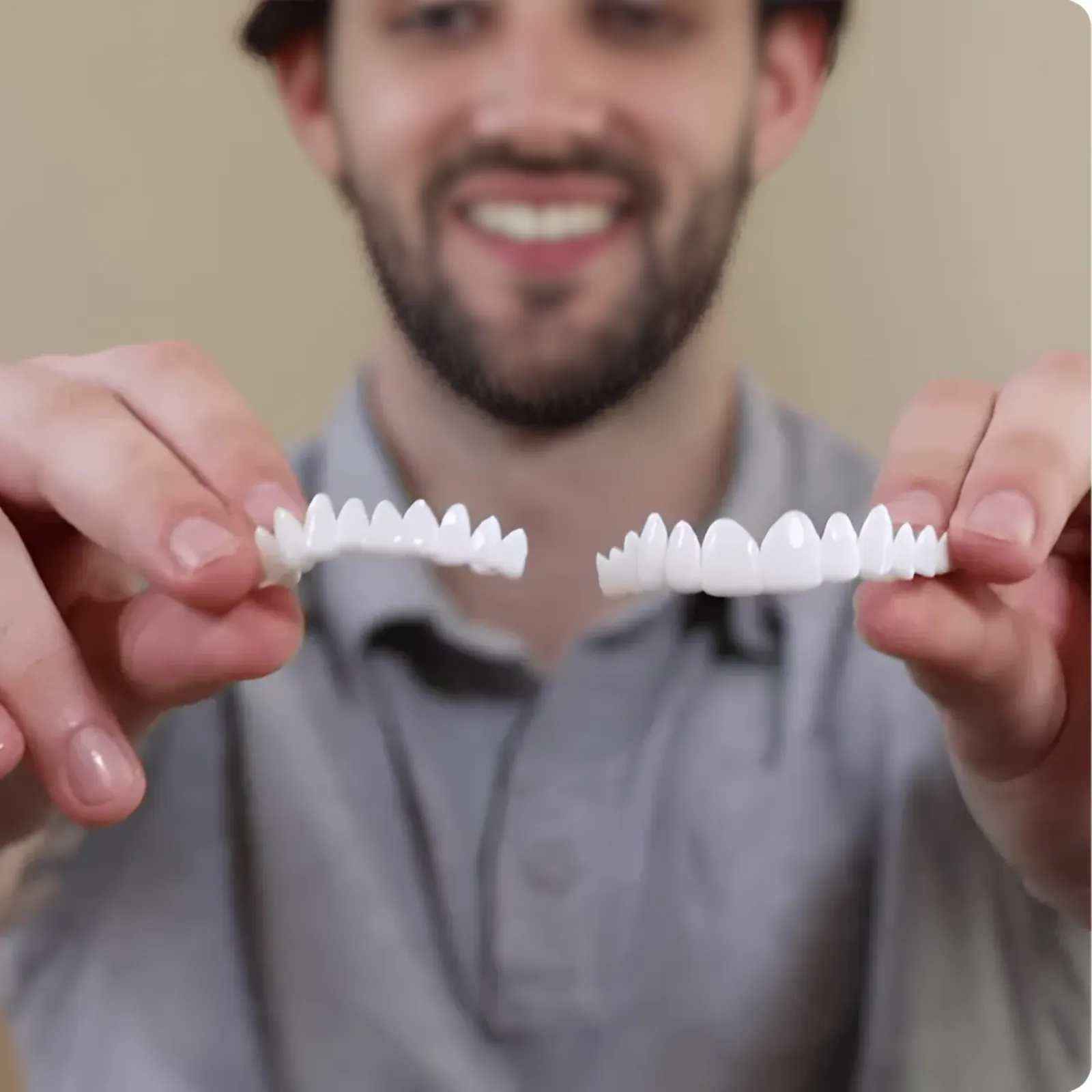 Facettes dentaires souples à clipser – Sourire immédiat sans douleur
