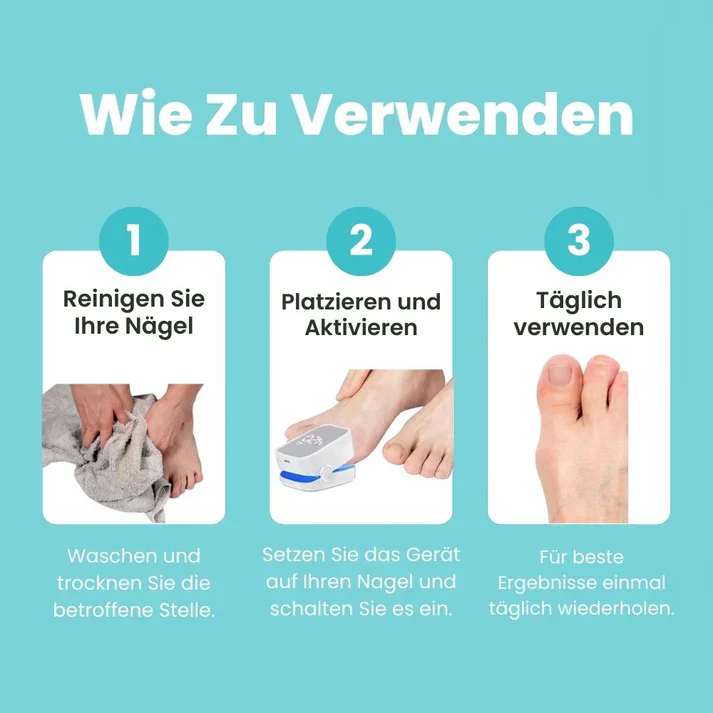FungiClear Pro – Appareil laser contre la mycose des ongles - Image 8
