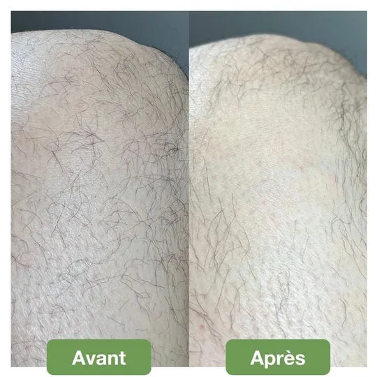 Gomme dâĂpilation Douce - Image 2