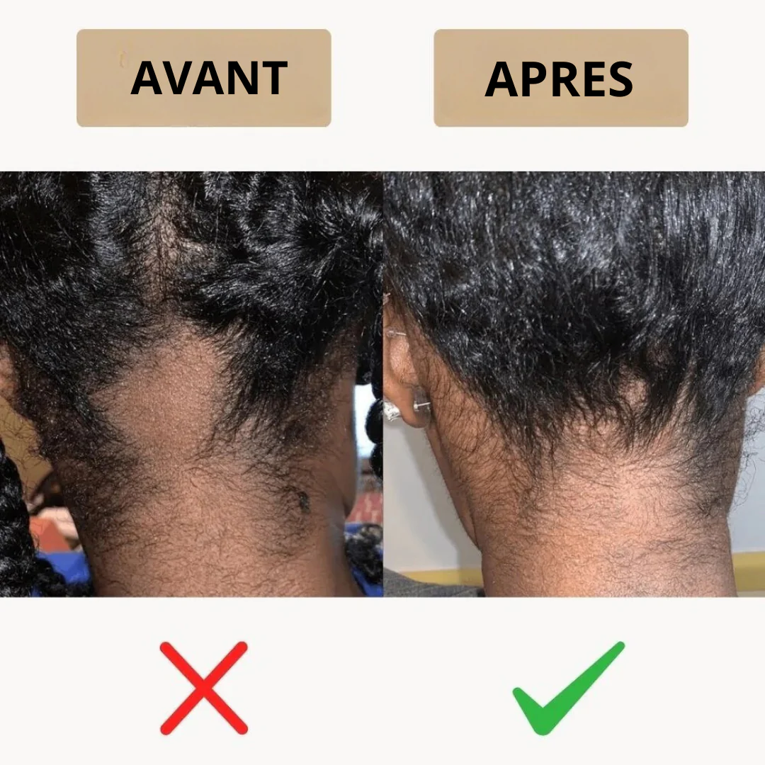 Soin capillaire nourrissant - Image 5