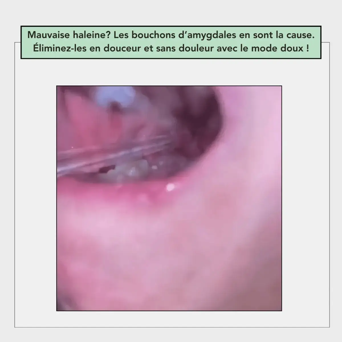 HYDROPULSEUR DENTAIRE - Image 11