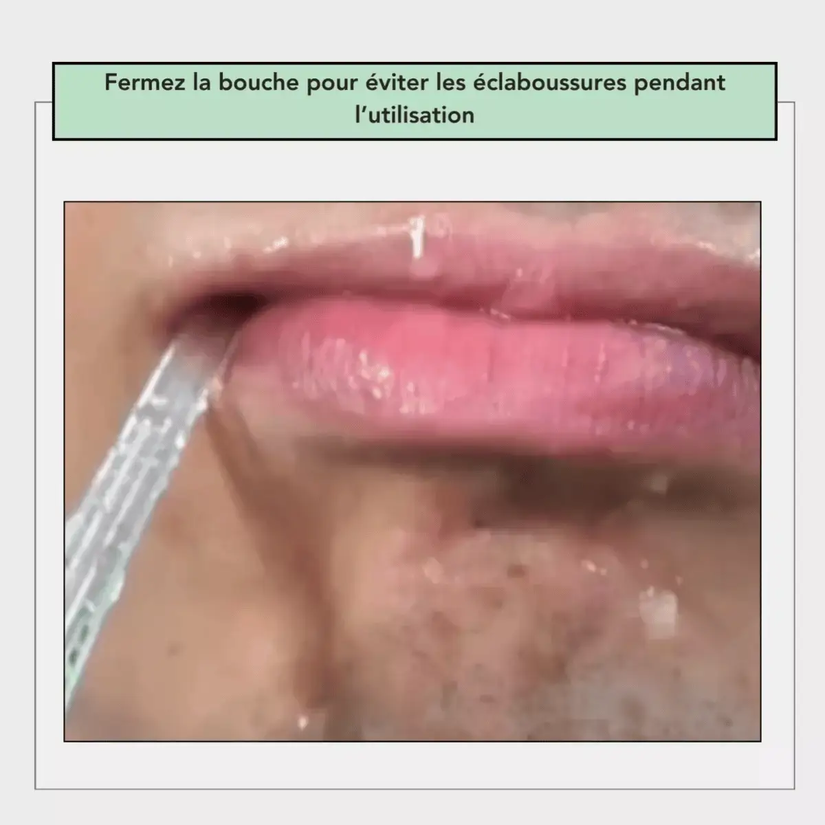 HYDROPULSEUR DENTAIRE - Image 13