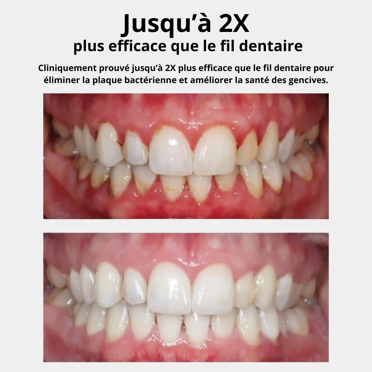 HYDROPULSEUR DENTAIRE - Image 6