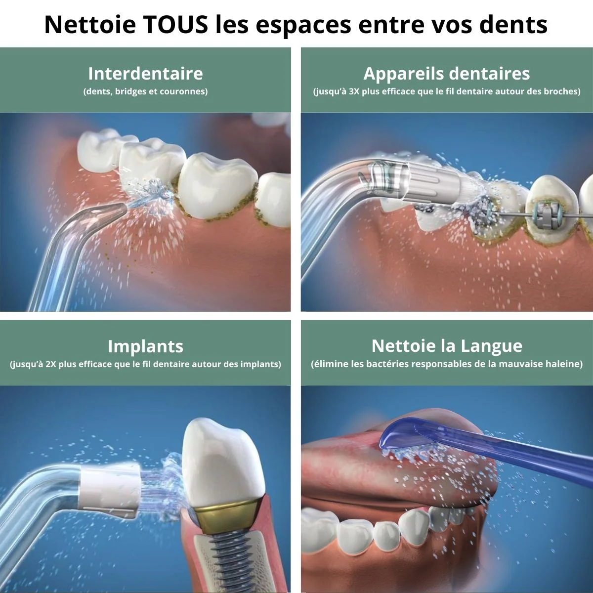 HYDROPULSEUR DENTAIRE - Image 7