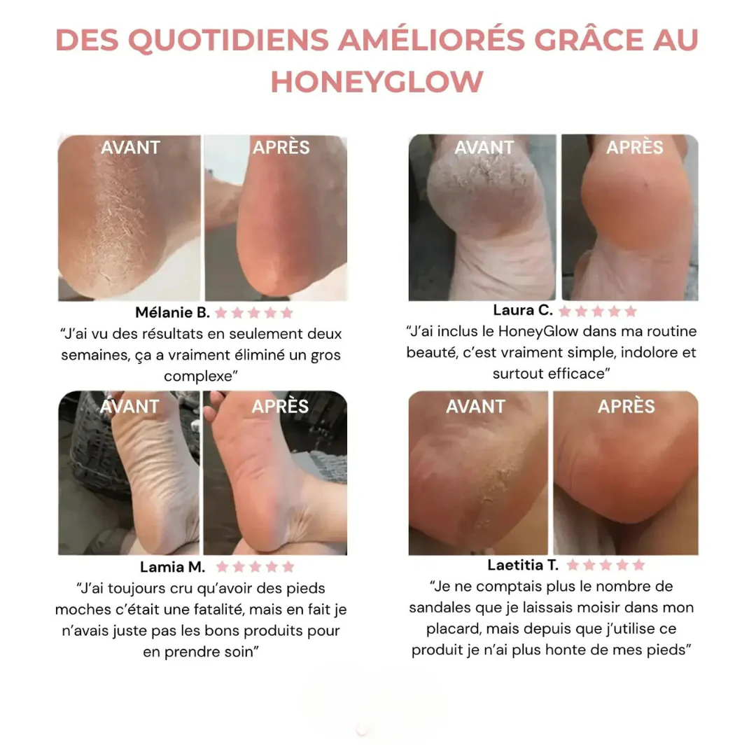 Kit Beauté Pieds - Image 4