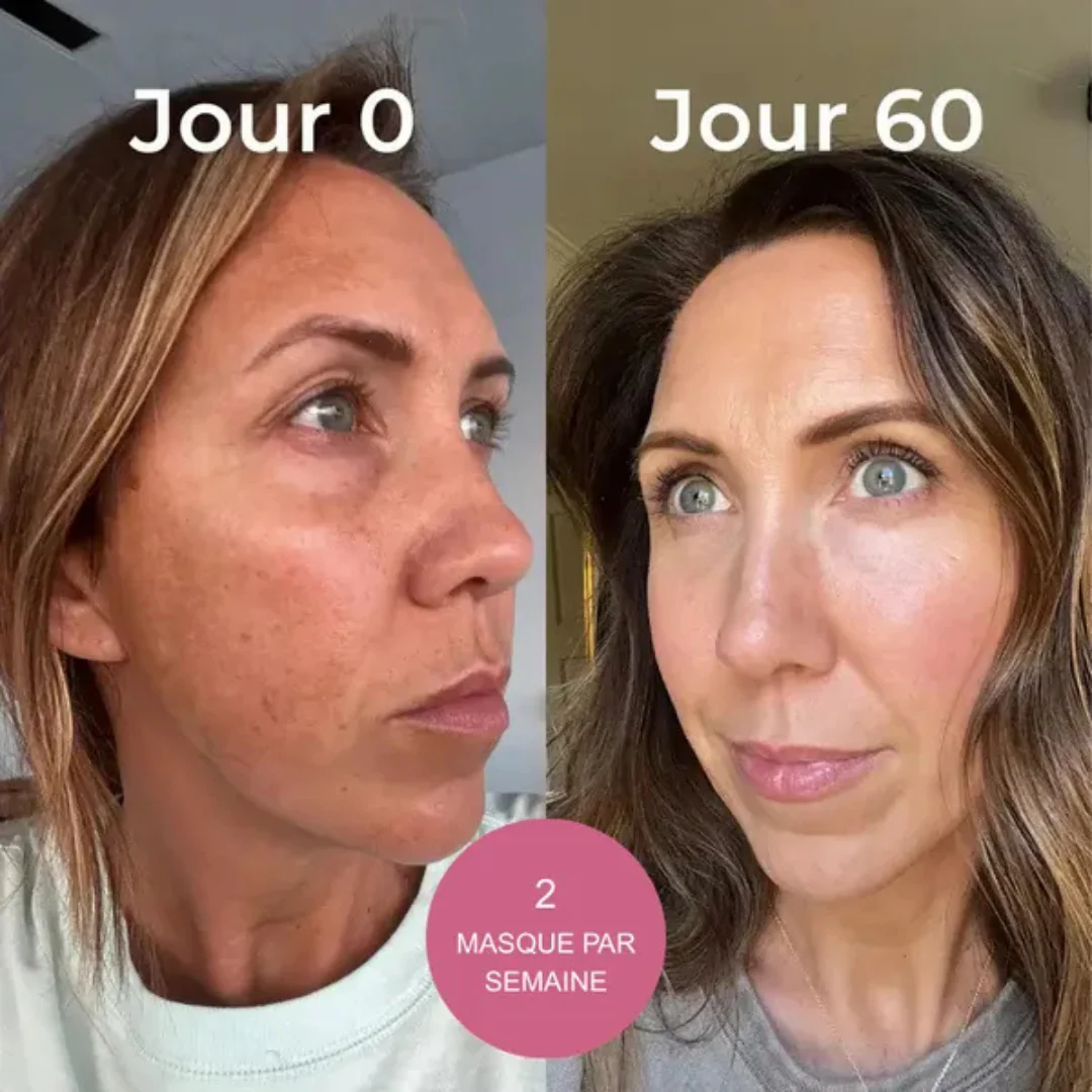 Masque visage collagène - Image 5