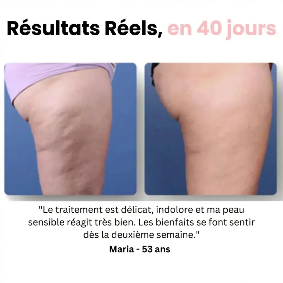 Masseur anti-cellulite électrique drainant - Image 7