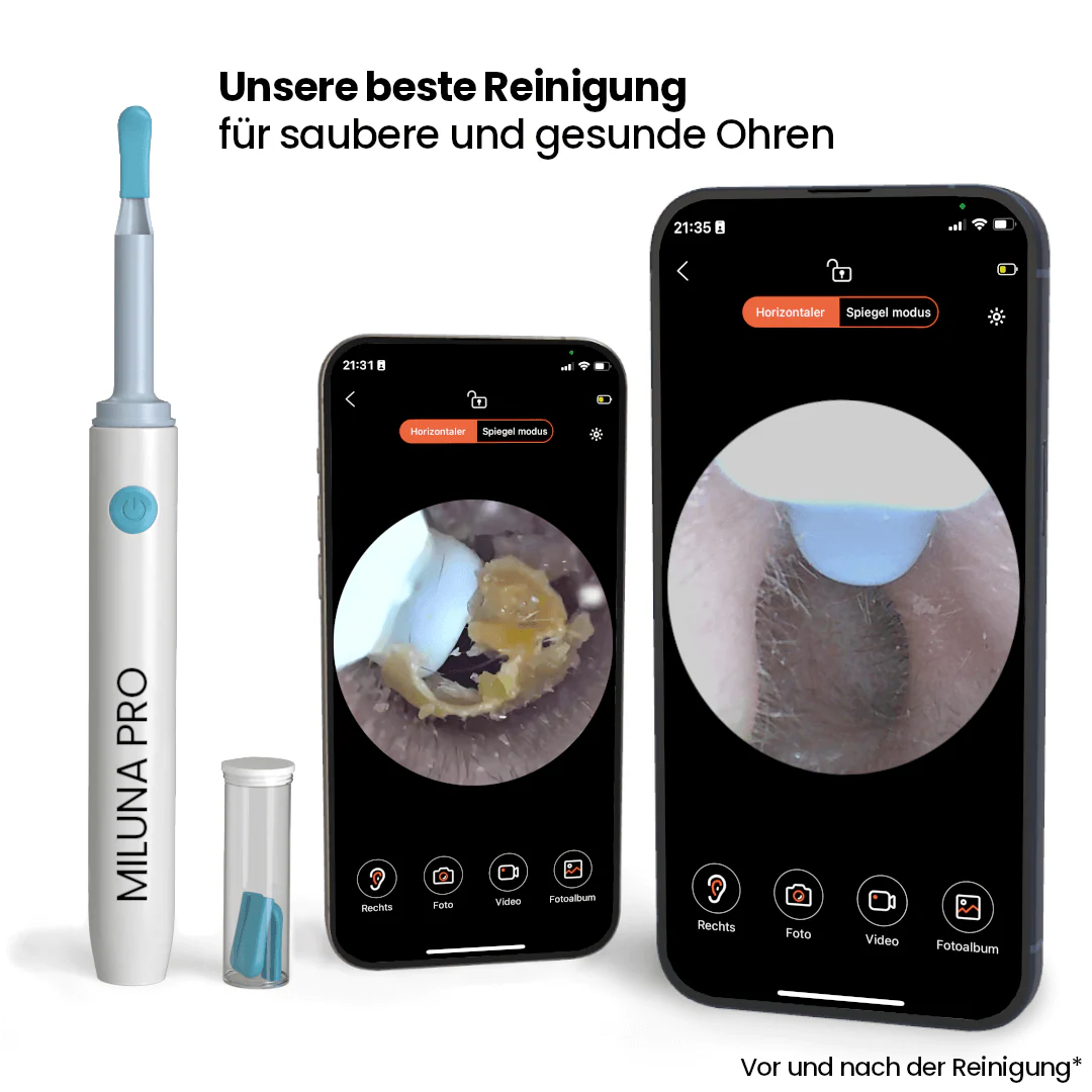 MilunaPro – Nettoyeur d’oreilles intelligent avec caméra HD - Image 4
