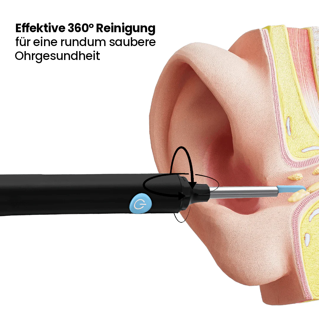 MilunaPro – Nettoyeur d’oreilles intelligent avec caméra HD - Image 5