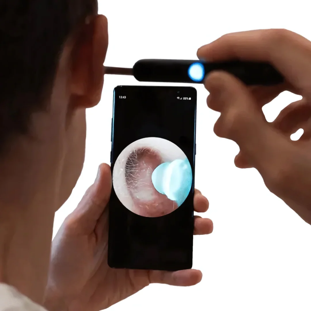 Nettoyeur d’oreille intelligent avec caméra HD - Image 7