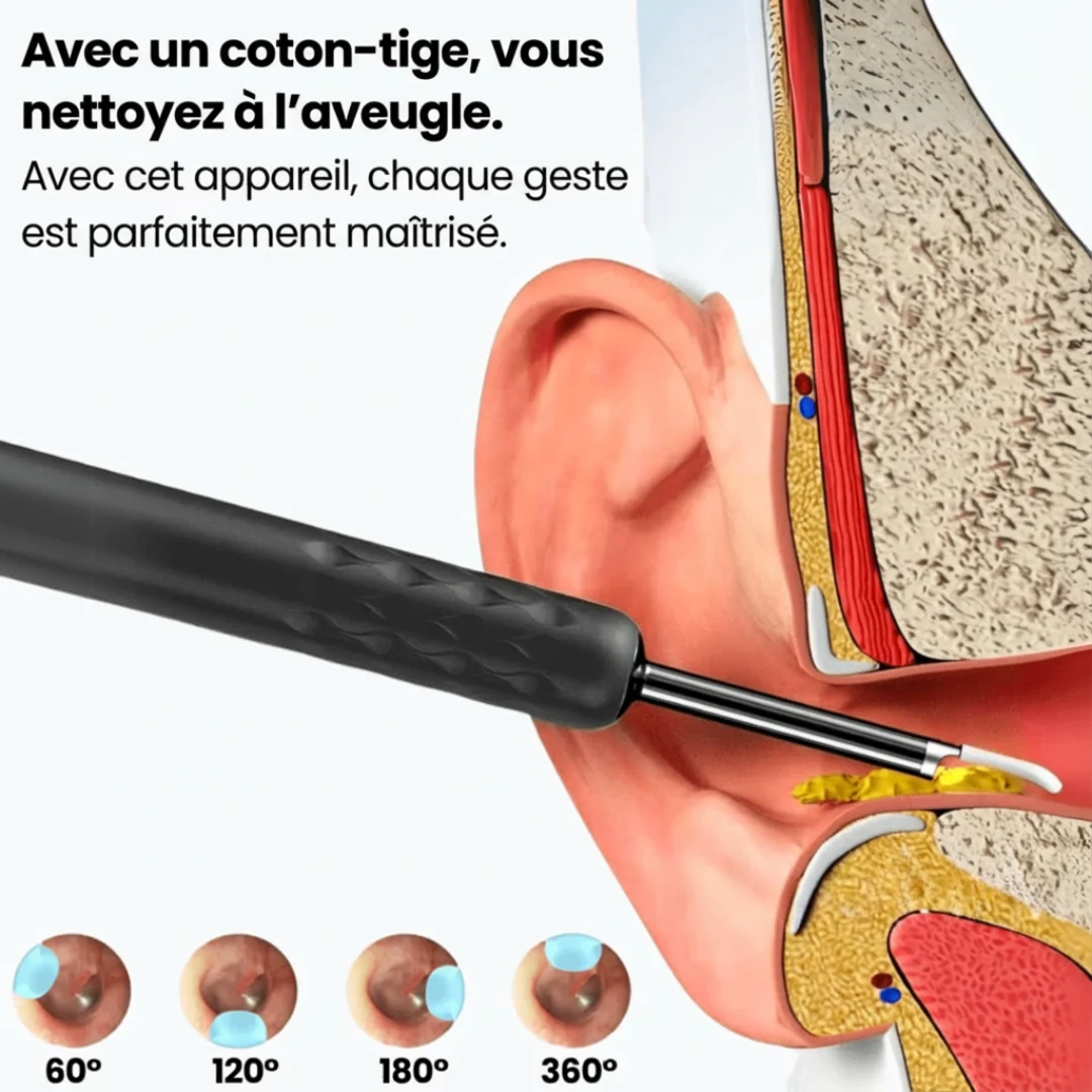 Nettoyeur d’oreilles avec caméra HD - Image 12