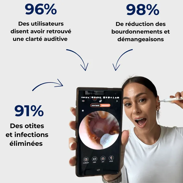 Nettoyeur d’oreilles avec caméra HD - Image 4