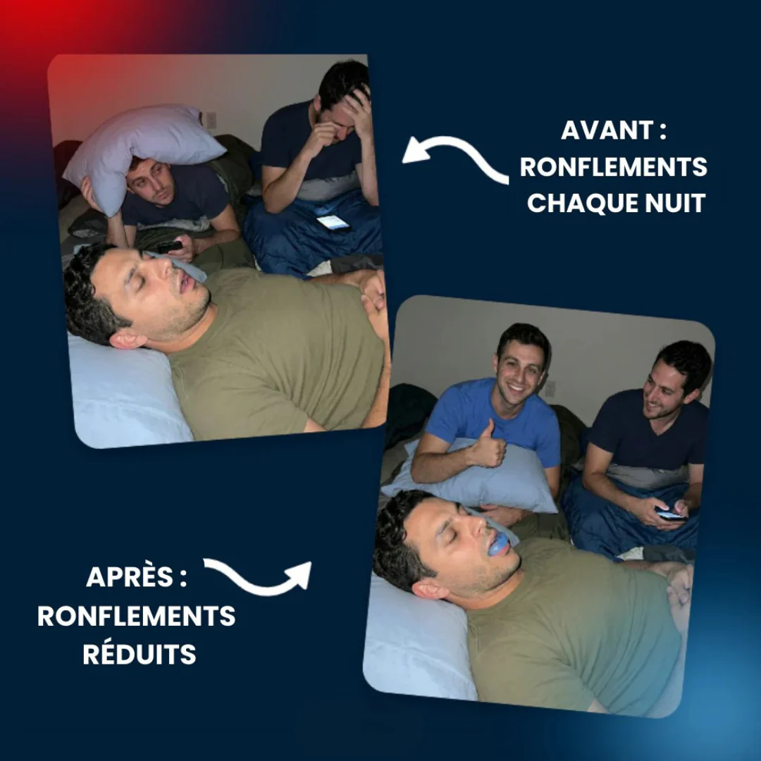 Orthèse Anti-Ronflement Ajustable - Image 3