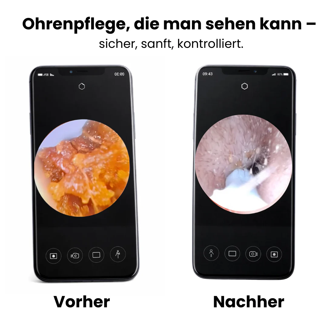 Otoscope Connecté HD pour Nettoyage des Oreilles - Image 6