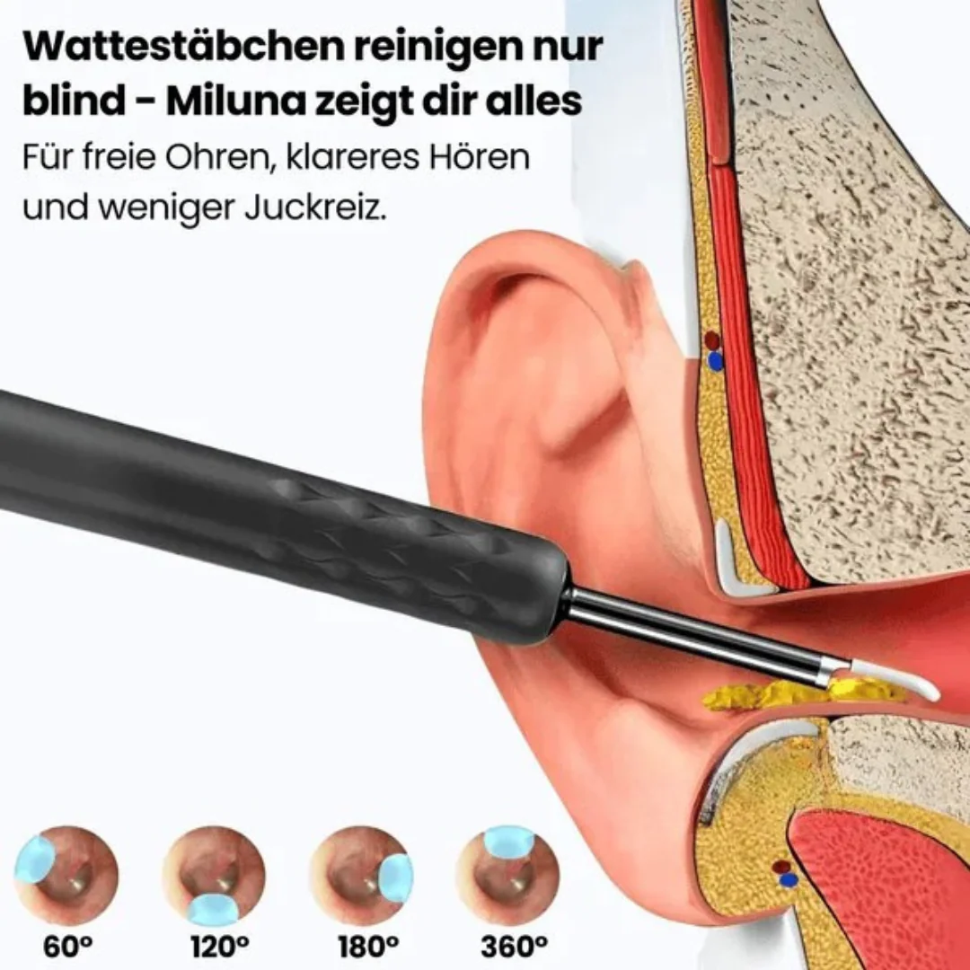 Otoscope numérique HD - Image 7