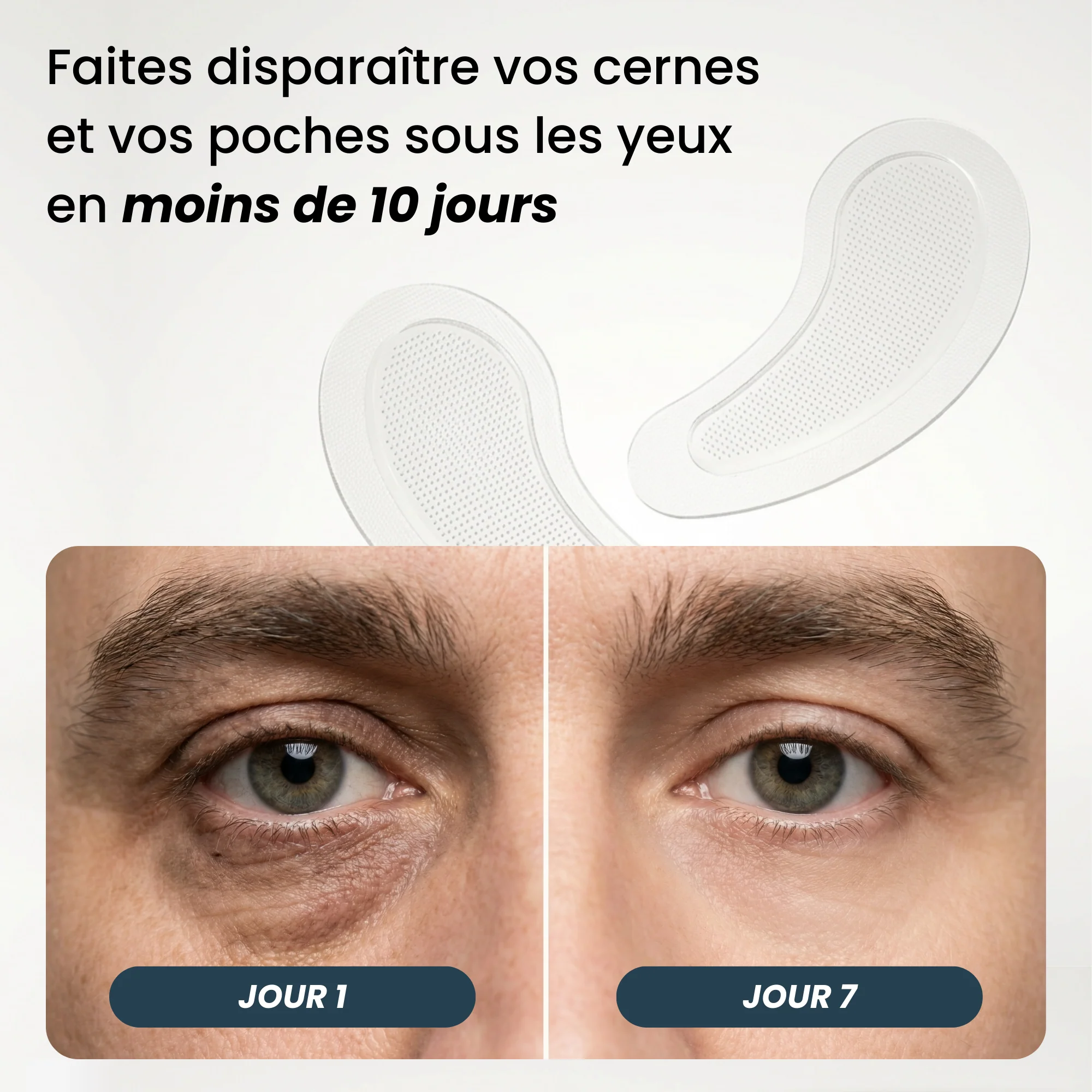 Patchs Anti-Cernes Micro-Aiguilles - Image 2