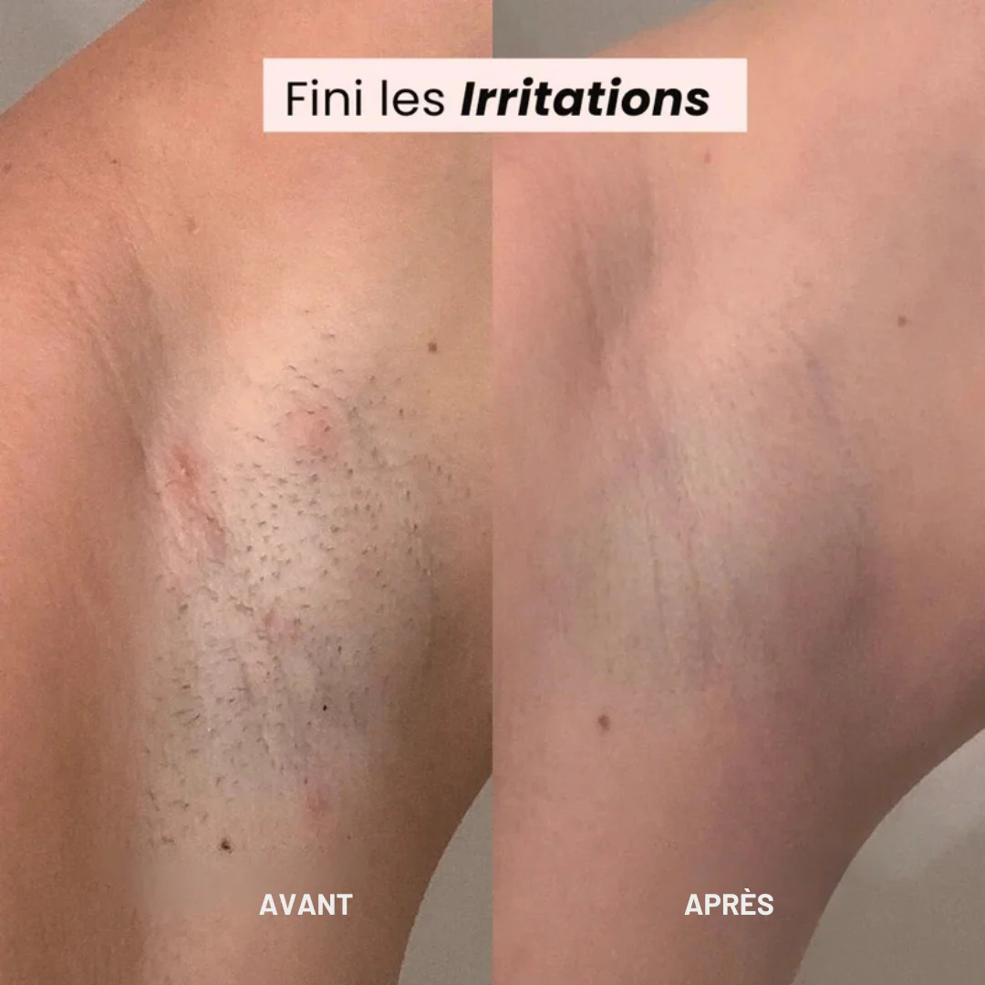 Rasoir électrique 2-en-1 pour une peau lisse et sans irritation - Image 4