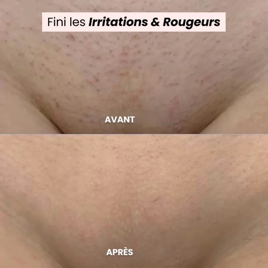 Rasoir électrique zones sensibles - Image 8