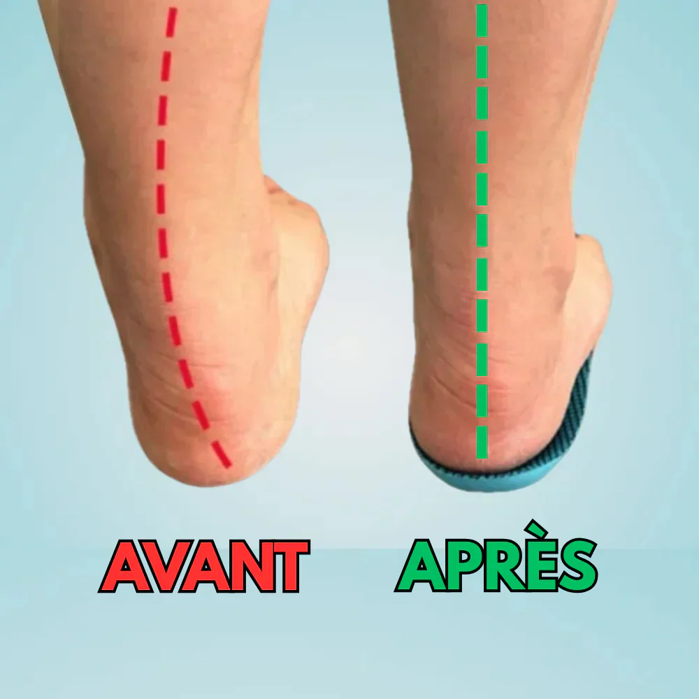 Semelles orthopédiques anti-douleur pour pieds sensibles - Image 5