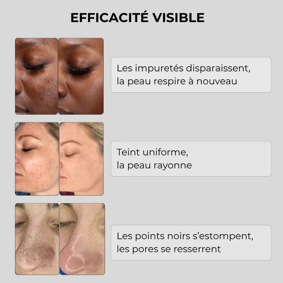 Sérum Correcteur Éclat - Image 7